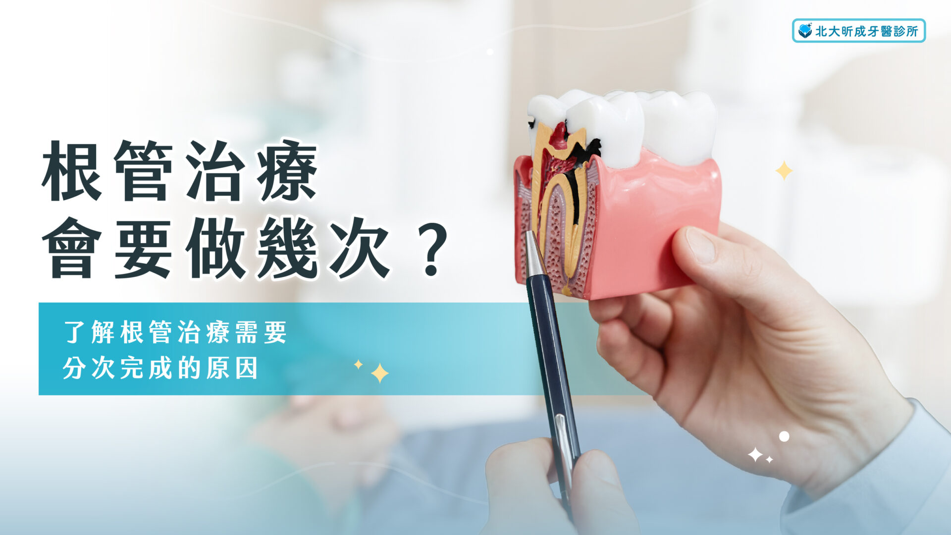 Read more about the article 根管治療會要做幾次？了解根管治療需要分次完成的原因