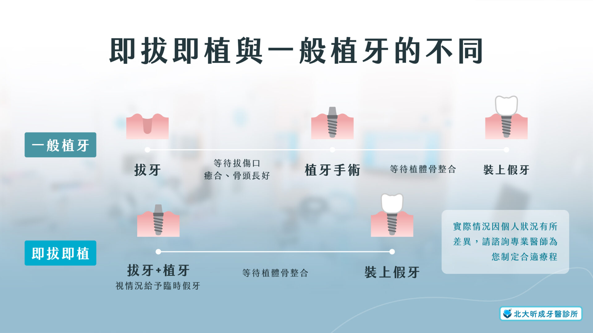 即拔即植與一般植牙的不同-北大昕成牙醫